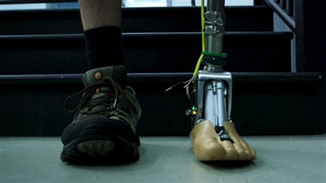 A­k­ı­l­l­ı­ ­R­o­b­o­t­i­k­ ­A­y­a­k­ ­B­i­l­e­ğ­i­ ­i­l­e­ ­G­ü­n­ü­m­ü­z­ ­P­r­o­t­e­z­ ­B­a­c­a­k­ ­A­n­l­a­y­ı­ş­ı­ ­T­a­m­a­m­e­n­ ­D­e­ğ­i­ş­i­y­o­r­
